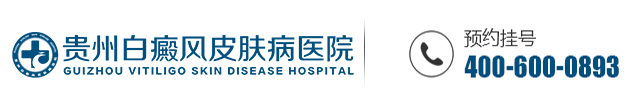 贵州白癜风皮肤病医院